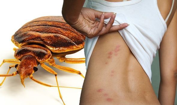 bed bug services in Hyderabad